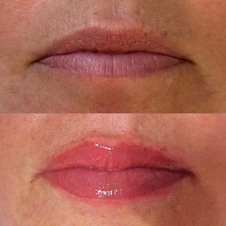 Lip Blush Bath